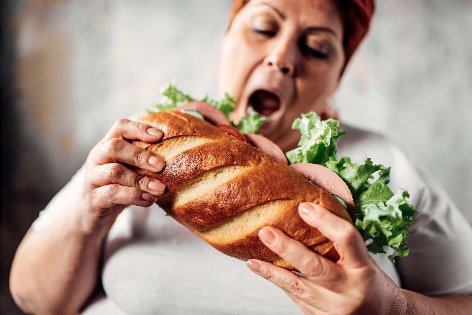 Overeating-Obesity